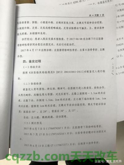 了解：医疗事故成植物人怎么赔偿 道路交通事故人身伤害伤残鉴定标准  第2张